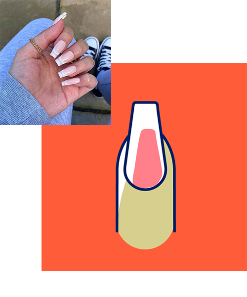 block image