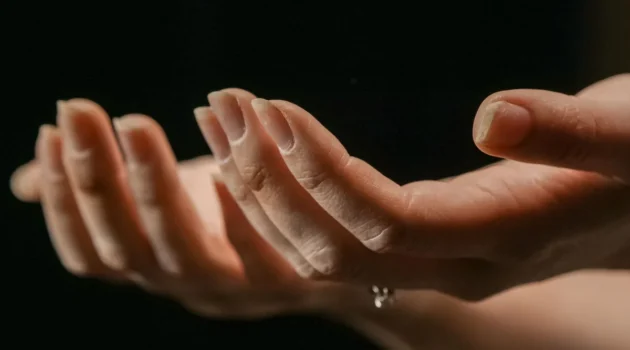 Two hands outstretched with palms up showing flaking nails